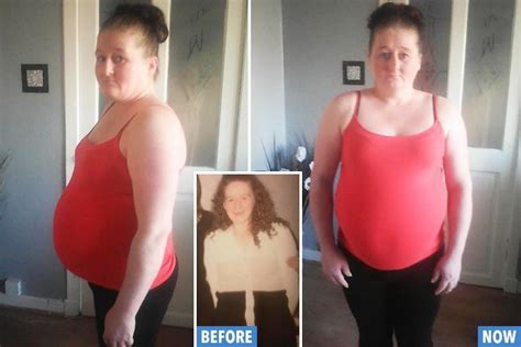 Scots Mum Left With A Bulging Belly Caused By A Bowel Blockage Cant
