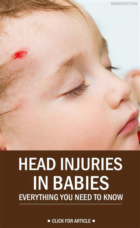 Baby Health Momjunction A Community For Moms Toddler Head Injury