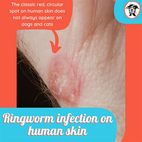 Ringworm Your Vet Wants You To Know