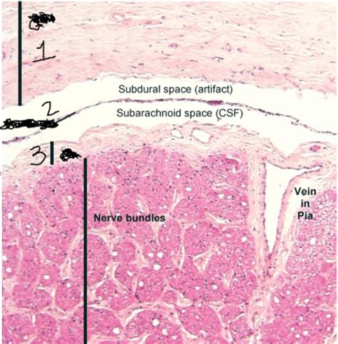 B B Histopathology Flashcards Quizlet