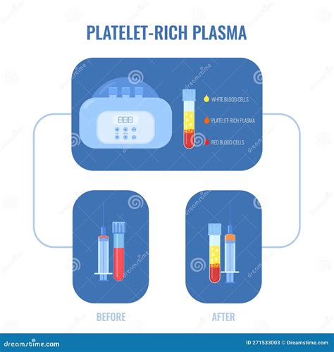 Human Blood Plasma After Centrifugation Infographic Poster Stock Vector