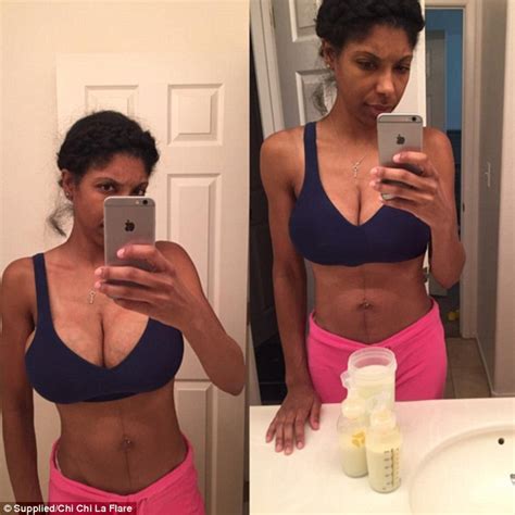 Mother Shares Very Candid Snap Of Her Breasts Before And After