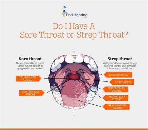 The Signs Of Strep Throat