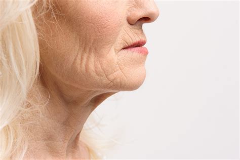 Aging Turkey Neck Vargas Face And Skin Center