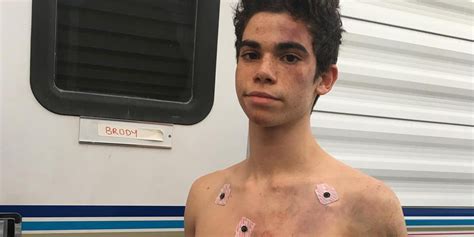 Code black bloopers, code black bombshell, cardi b code black remix, code black cheer extreme, code black cameron boyce full. Cameron Boyce Guest Stars On CBS' 'Code Black' Tonight ...