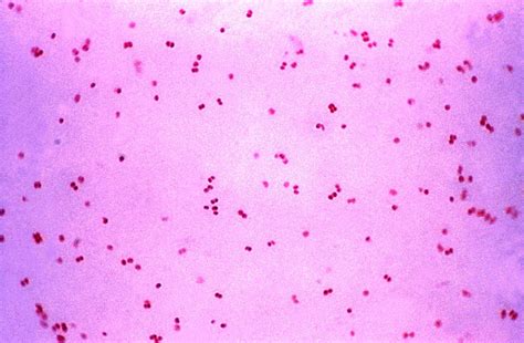 Imagen gratis microfotografía gramo negativo bacterias Neisseria gonorrhoeae