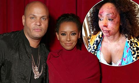 mel b s ex husband stephen belafonte jets into london after her video to highlight domestic