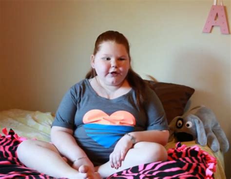 Year Old Girl With Rare Uncontrollable Weight Gain Loses Pounds After Surgery