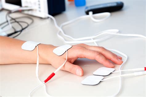 Nmes Use Of Electrical Stimulation From History To The Present Day