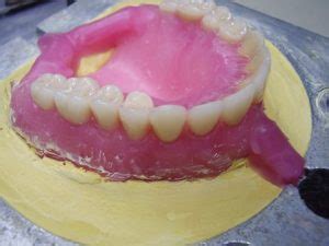 We did not find results for: Harga Pasang Gigi Palsu | Audy Dental