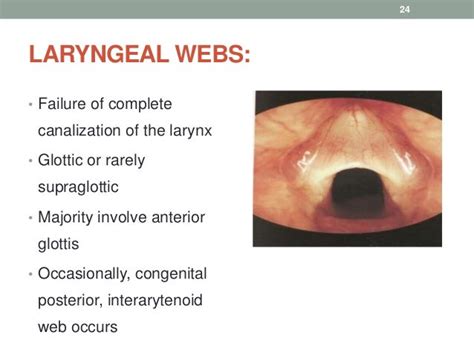 Congenital Anomalies Of Larynx