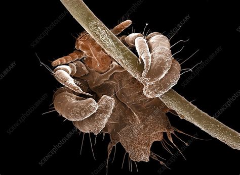 Pubic Louse Sem Stock Image C Science Photo Library