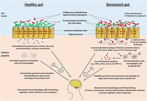 Gut Microbiome And Aging Physiological And Mechanistic Insights Ios