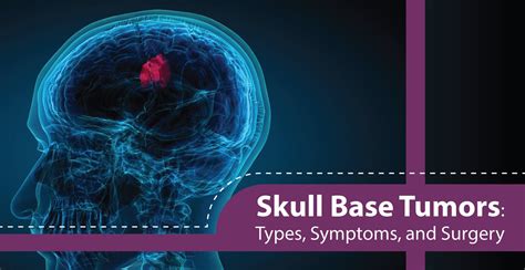Skull Base Tumors Types Symptoms And Surgery Ace Ent Clinic