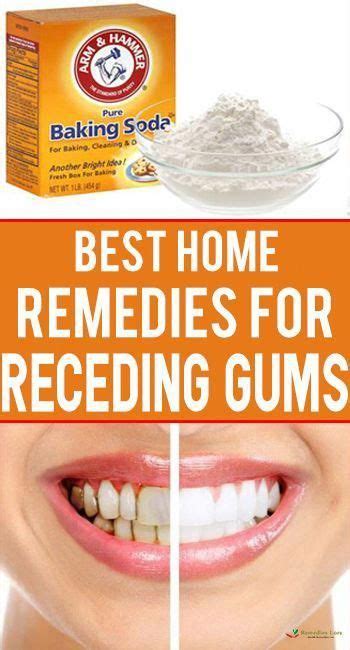 Best Home Remedies For Receding Gums Natural Home Remedies Best Home