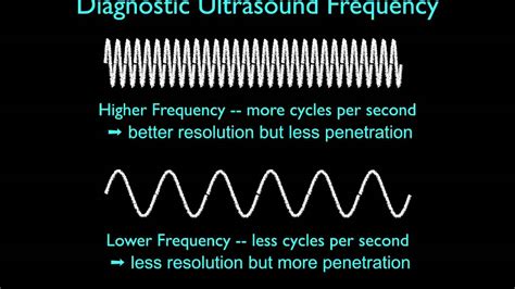 Ultrasound Physics Basics Physics And Image Generation Youtube