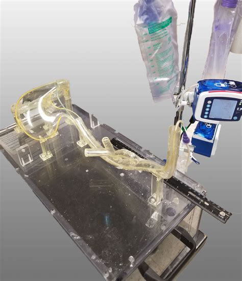 Prophylactic Use Of The Tubeclear System Reduces Feeding Tube Material