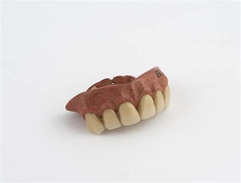 Partial Upper Denture Science Museum Group Collection