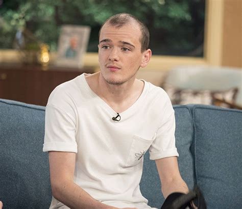 Britains Got Talent Star George Sampson Shows Off Results Of Hair Transplants Hello