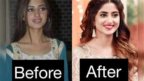 pakistani actress before and after plastic surgery top ten drama stars2019 youtube