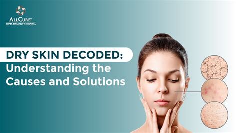 Dry Skin Decoded Understanding The Causes And Solutions