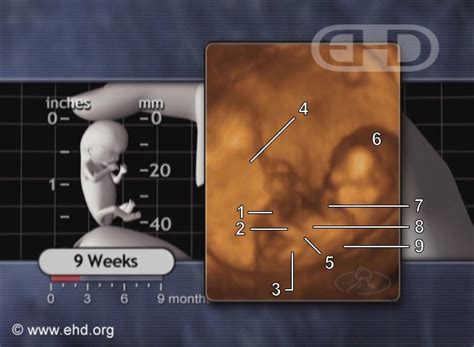 The 9 Week Fetus In Motion