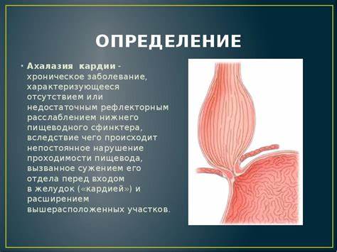 Недостаточность розетки кардии диета Доклад: Ахалазия кардии — Хелп Диплом — исследовательские работы! Доклад: Ахалазия кардии — Хелп Диплом — исследовательские работы! Недостаточность розетки кардии диета