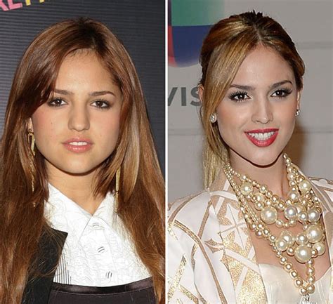 Eiza Gonzalez Plastic Surgery Before And After Photos Lovely Surgery