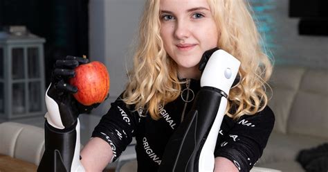 brave girl who lost hands to meningitis can finally give thumbs up thanks to bionic arms
