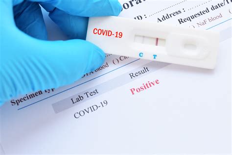 Lab information & test types. COVID-19 testing positivity rate hits new record in Puerto ...