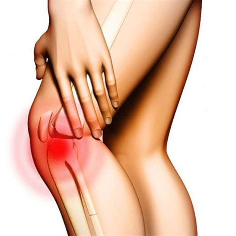 Gonarthrose du genou qu est ce que c est symptômes et causes