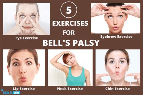 5 Best Exercises For Bells Palsy Treatment At Home How To Cure