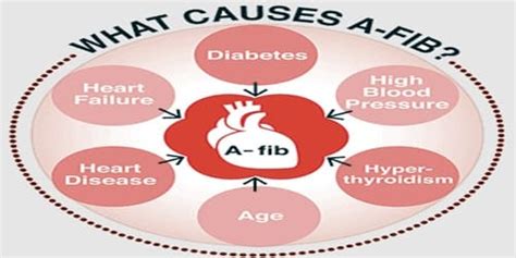 Atrial Fibrillation Causes Risk Factors And Complications