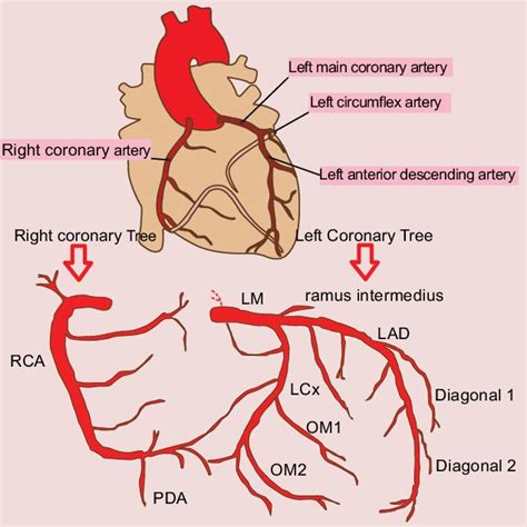 Смотреть что такое diagonal arteries в других словарях: Number Of Diagonal Arteries - Anatomical Attributes Of ...