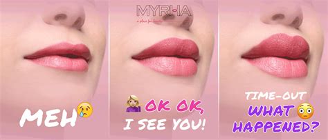 How Much Lip Filler Is Too Much — Myrha Beauty