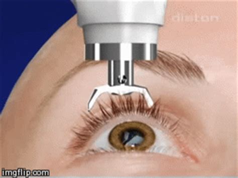 Trending images, videos and gifs related to flip! Tonometer Diaton through the Eyelid tonometry - Imgflip