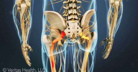 It is located just above the brain stem and toward the back of the brain. Sciatica: "Pain is shooting down my leg!" | Blog | Thompson Physical Therapy