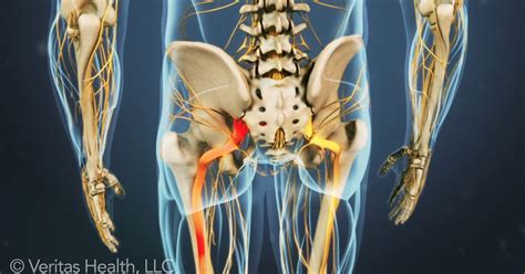 Interactive and dynamic anatomical atlas of anatomy. Sciatica: "Pain is shooting down my leg!" | Blog | Thompson Physical Therapy