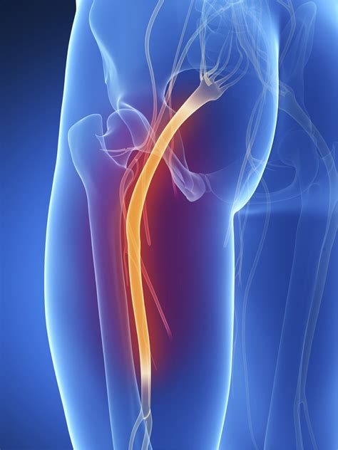 Back pain is the big problem in our life. The Ultimate Guide to Sciatic Nerve Pain - The Asana Academy