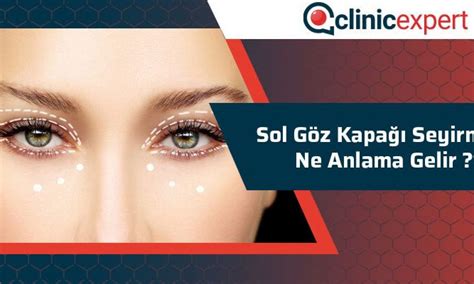 sözlü susuzluk şarkıcı göz seyirmesi ne anlama gelir geçit karar dilekçe