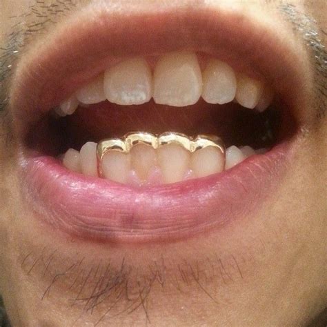 We work directly with the dentist who specializes in placing permanent gold teeth. Pinterest: Lina Heller | Grillz, Gold teeth, Teeth jewelry