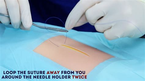 Simple Interrupted Suture Osce Guide Wound Suturing Geeky Medics