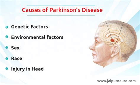Parkinsons Disease Treatment In Jaipur Dr Vikram Bohra Neurologist