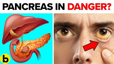 7 Warning Signs Your Pancreas Is In Trouble Youtube