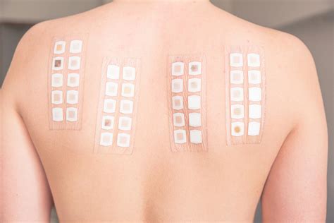 Patch Test - Cosmetic Testing Lab