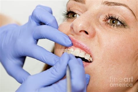Orthodontist Tightening Braces Photograph By Microgen Images Science Photo Library