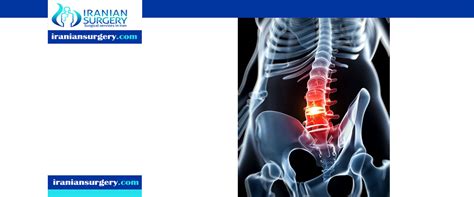 If you have recurrent symptoms from a herniated disc, there are known surgical options that have. How to treat a herniated disc without surgery?| Fix ...