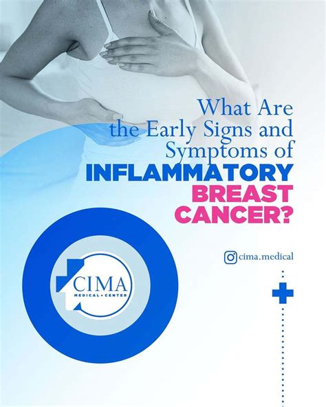what are the early signs and symptoms of inflammatory breast cancer miami