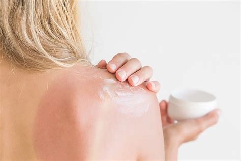 How To Soothe And Heal Sunburn Fast Home Remedies For