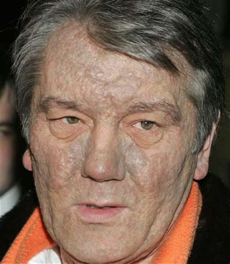 Associated pressukrainian president viktor yushchenko, left, and u.s. Ukrainian presidential hopeful Viktor Yushchenko poisoned